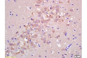 Formalin-fixed and paraffin embedded rat brain labeled with Rabbit Anti FIS1/TTC11 Polyclonal Antibody, Unconjugated (ABIN872461) at 1:200 followed by conjugation to the secondary antibody and DAB staining (Fission 1 antibody  (AA 55-152))