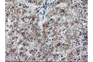 Immunohistochemistry (IHC) image for anti-Ribophorin 1 (RPN1) antibody (ABIN1500748) (RPN1 antibody)