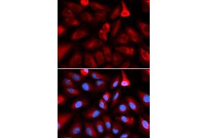 Immunofluorescence analysis of U2OS cells using FKBP4 antibody.