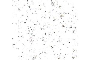 anti-N-Myc Proto-Oncogene Protein (MYCN) (AA 100-150) antibody
