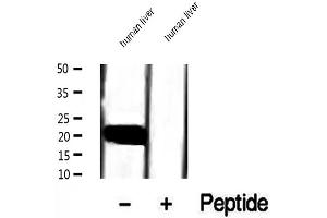 Western blot analysis of extracts of human liver tissue, using COMMD1 antibody. (COMMD1 antibody  (Internal Region))