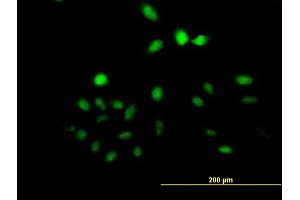 Immunofluorescence of purified MaxPab antibody to UTP11L on HeLa cell. (UTP11L antibody  (AA 1-253))