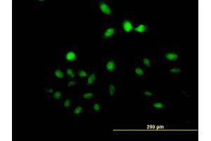 Immunofluorescence of purified MaxPab antibody to UTP11L on HeLa cell.