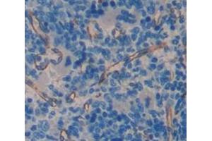 Figure. (STING/TMEM173 antibody  (AA 160-363))