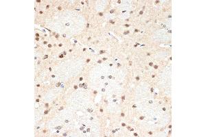 Immunohistochemistry of paraffin-embedded rat brain using PSM Rabbit mAb (ABIN7269597) at dilution of 1:100 (40x lens).