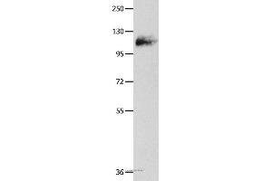 Western blot analysis of Mouse lung tissue, using AMPH Polyclonal Antibody at dilution of 1:500 (Amphiphysin antibody)