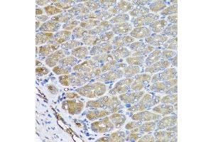 Immunohistochemistry of paraffin-embedded mouse stomach using VPS37A antibody at dilution of 1:100 (x40 lens). (VPS37A antibody)