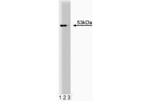 Western blot analysis of p53 on A431 lysate. (p53 antibody  (AA 195-393))