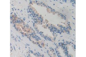 Used in DAB staining on fromalin fixed paraffin- embedded Kidney tissue (GRK6 antibody  (AA 186-448))