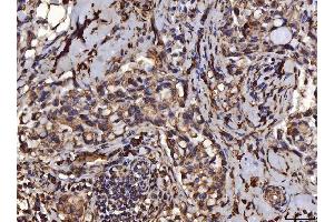 IHC analysis of PDIA6 using anti-PDIA6 antibody (ABIN7600554). (PDIA6 antibody  (AA 20-440))