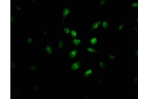 Immunofluorescence staining of U251 cells with ABIN7163461 at 1:100, counter-stained with DAPI. (Pirin antibody  (AA 1-290))