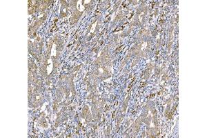 IHC analysis of SND1 using anti-SND1 antibody (ABIN7600526).