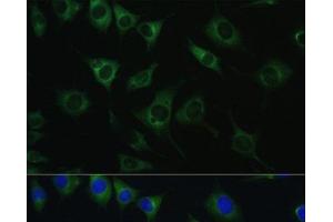 Immunofluorescence analysis of L929 cells using SRPRB Polyclonal Antibody at dilution of 1:100. (SRPRB antibody)