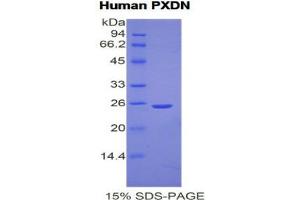 SDS-PAGE (SDS) image for Peroxidasin Homolog (PXDN) (AA 76-260) protein (His tag) (ABIN2121830) (Peroxidasin Protein (AA 76-260) (His tag))