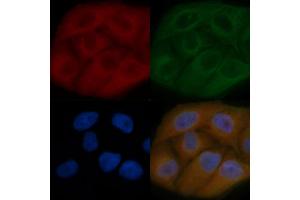 POMK Mouse Monoclonal Antibody staining Hela cells by IF/ICC.