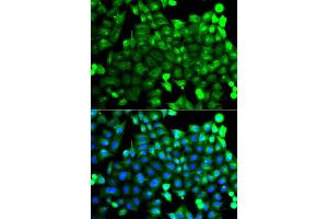 Immunofluorescence analysis of A549 cells using NCALD antibody.