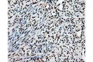 Immunohistochemical staining of paraffin-embedded Kidney tissue using anti-PTPRE mouse monoclonal antibody.