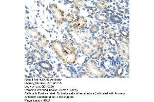 Rabbit Anti-NOC4L Antibody  Paraffin Embedded Tissue: Human Kidney Cellular Data: Epithelial cells of renal tubule Antibody Concentration: 4. (NOC4L antibody  (C-Term))