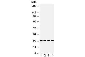 Western blot testing of 1) rat skeletal muscle, 2) mouse heart, 3) human MCF7 and 4) HeLa lysate with BAK antibody. (BAK1 antibody  (AA 22-211))