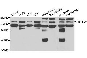 Western blot analysis of extracts of various cell lines, using KBTBD7 antibody (ABIN5975133) at 1/1000 dilution. (KBTBD7 antibody)