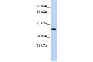 Western Blotting (WB) image for anti-CPX Chromosome Region, Candidate 1 (CPXCR1) antibody (ABIN2458436) (CPXCR1 antibody)