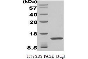 SDS-PAGE (SDS) image for Transforming Growth Factor, beta-Induced, 68kDa (TGFBI) protein (ABIN667042) (TGFBI Protein)