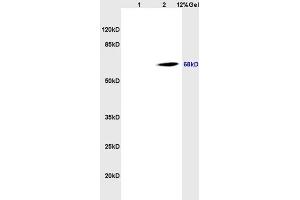 Lane 1: rat brain lysates Lane 2: human colon carcinoma lysates probed with Anti CD98 Polyclonal Antibody, Unconjugated (ABIN719546) at 1:200 in 4 °C. (SLC3A2 antibody  (AA 231-280))
