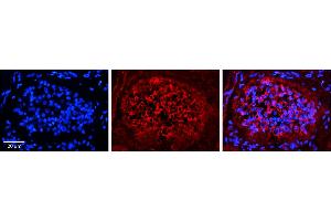 Immunohistochemistry (IHC) image for anti-Exportin 1 (XPO1) (C-Term) antibody (ABIN2778849)