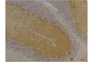 Immunohistochemistry (IHC) analysis of paraffin-embedded Rat Brain Tissue using KCNN3(SK3) Rabbit Polyclonal Antibody diluted at 1:200. (KCNN3 antibody)