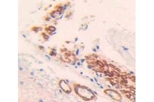 Used in DAB staining on fromalin fixed paraffin- embedded Kidney tissue (TMEFF1 antibody  (AA 58-312))