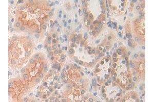 Immunohistochemistry (IHC) image for anti-Pyridoxal Kinase (PDXK) (AA 29-253) antibody (ABIN7440257)