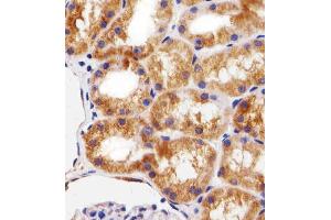 Immunohistochemical analysis of paraffin-embedded H. (BCL10 antibody  (AA 1-143))