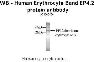 Image no. 1 for anti-erythrocyte Membrane Protein Band 4.2 (EPB42) antibody (ABIN346968)