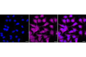 Immunocytochemical staining of HeLa cells with Deoxythymidylate kinase antibody (ABIN7798311), 1:1,000).