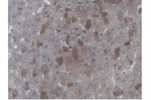 Detection of UBE2L3 in Human Liver Tissue using Polyclonal Antibody to Ubiquitin Conjugating Enzyme E2L3 (UBE2L3) (UBE2L3 antibody  (AA 4-154))