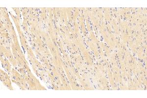Detection of BNP in Mouse Cardiac Muscle Tissue using Polyclonal Antibody to Brain Natriuretic Peptide (BNP) (BNP antibody  (AA 77-121))