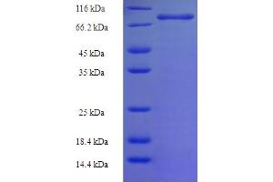 SDS-PAGE (SDS) image for Phosphoinositide-3-Kinase, Regulatory Subunit 5 (PIK3R5) (AA 1-494) protein (His-SUMO Tag) (ABIN5711599) (PIK3R5 Protein (AA 1-494) (His-SUMO Tag))