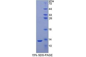SDS-PAGE (SDS) image for S100 Calcium Binding Protein A2 (S100A2) (AA 2-98) protein (His tag) (ABIN1080711)