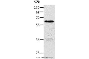Western blot analysis of 293T and K562 cell, using PAK1 Polyclonal Antibody at dilution of 1:700