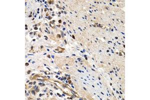 Immunohistochemistry of paraffin-embedded human colon using MCM2 antibody (ABIN5970415) at dilution of 1/200 (40x lens). (MCM2 antibody)