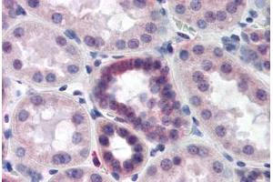 Human Kidney (formalin-fixed, paraffin-embedded) stained with CAND2 antibody ABIN218497 at 1:500 followed by biotinylated goat anti-rabbit IgG secondary antibody ABIN481713, alkaline phosphatase-streptavidin and chromogen. (CAND2 antibody  (C-Term))