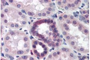 Human Kidney (formalin-fixed, paraffin-embedded) stained with CAND2 antibody ABIN218497 at 1:500 followed by biotinylated goat anti-rabbit IgG secondary antibody ABIN481713, alkaline phosphatase-streptavidin and chromogen. (CAND2 antibody  (C-Term))