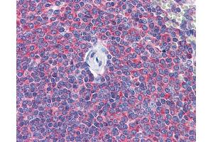 anti-SNAP-Associated Protein (SNAPIN) (AA 41-137) antibody