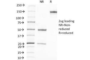 SDS-PAGE Analysis Purified PSA Mouse Monoclonal Antibody (A67-B/E3). (Prostate Specific Antigen antibody)