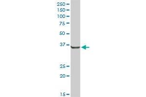 AKR7A2 MaxPab rabbit polyclonal antibody. (AKR7A2 antibody  (AA 1-330))