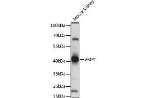 Western blot analysis of extracts of mouse kidney, using VMP1 antibody (ABIN7271283) at 1:1000 dilution. (VMP1 antibody  (C-Term))