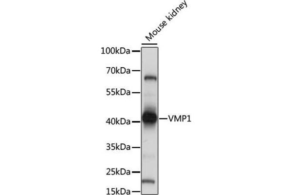 VMP1 antibody  (C-Term)