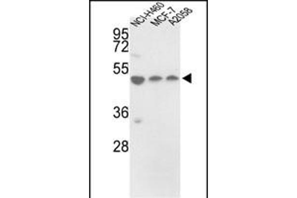 PDIA6 anticorps  (AA 236-264)