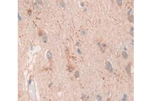 Figure. (GAN antibody  (AA 30-326))
