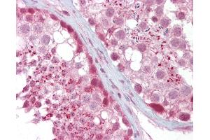 Anti-IFT88 antibody IHC of human testis. (IFT88 antibody  (AA 721-770))